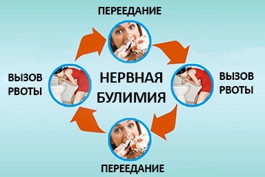 Лечение булимии в Белиджи